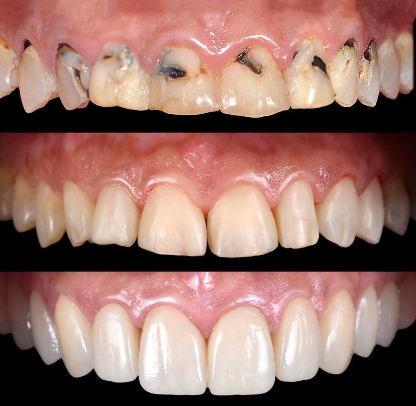Protodoncia rehabilitacion boca Jerez